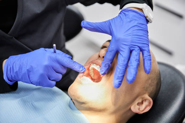 Best Emergency Dentist for Lost Fillings or Crowns in Cleveland, AL