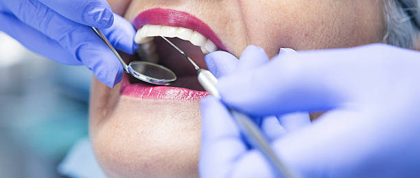 Best Emergency Dental Services for Seniors in Cleveland, AL